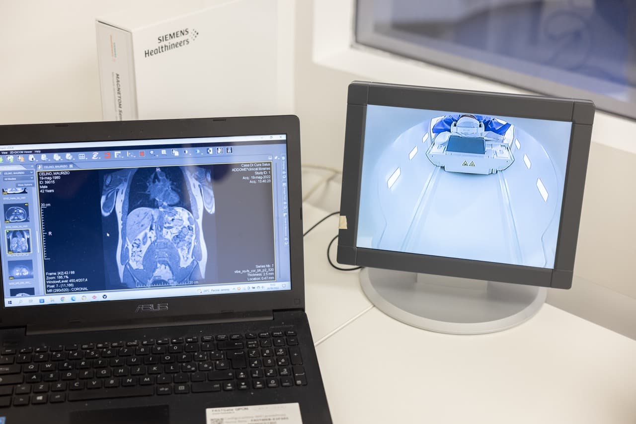 Postazione di refertazione con tecnologia Siemens Healthineers